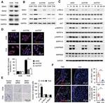 SNAIL Antibody in Immunohistochemistry, Immunocytochemistry (IHC, ICC/IF)
