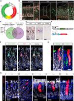 MUC5AC Antibody in Immunohistochemistry, Immunocytochemistry (IHC, ICC/IF)
