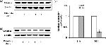 Catalase Antibody in Western Blot (WB)