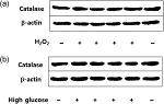 Catalase Antibody in Western Blot (WB)