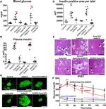 Insulin Antibody in Immunohistochemistry, Immunocytochemistry (IHC, ICC/IF)