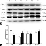 CDKL1 Antibody in Western Blot (WB)