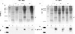 Mycobacterium tuberculosis ESAT-6 Antibody in Western Blot (WB)