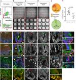 CD44 Antibody in Immunohistochemistry, Immunocytochemistry (IHC, ICC/IF)