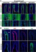 SMAD2 Antibody in Immunohistochemistry (Paraffin) (IHC (P))