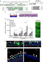 MUC5AC Antibody in Immunohistochemistry, Immunocytochemistry (IHC, ICC/IF)