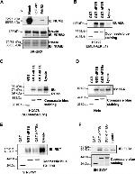 ErbB2 (HER-2) Antibody in Western Blot, Immunoprecipitation (WB, IP)