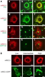 PDI Antibody in Immunocytochemistry (ICC/IF)