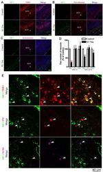 Parvalbumin Antibody in Immunohistochemistry - Free Floating (IHC (Free))