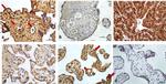 VEGF Antibody in Immunohistochemistry (IHC)