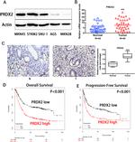 PRDX2 Antibody in Immunohistochemistry (IHC)