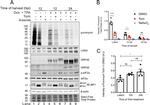 KSHV ORF45 Antibody in Western Blot (WB)