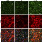 ZO-1 Antibody in Immunocytochemistry (ICC/IF)