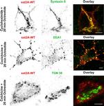 TGN46 Antibody in Immunohistochemistry, Immunocytochemistry (IHC, ICC/IF)