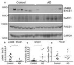 Phospho-BACE1 (Ser498) Antibody in Western Blot (WB)