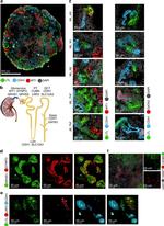 WT1 Antibody in Immunohistochemistry, Immunocytochemistry (IHC, ICC/IF)