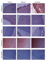 Elastin Antibody in Immunohistochemistry (Paraffin) (IHC (P))