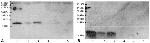 Mycobacterium tuberculosis CFP-10 Antibody in Western Blot (WB)
