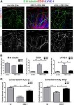 LYVE1 Antibody in Immunohistochemistry, Immunocytochemistry (IHC, ICC/IF)