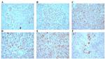 ING4 Antibody in Immunohistochemistry (IHC)
