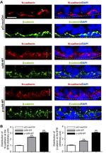 beta Catenin Antibody in Immunohistochemistry, Immunocytochemistry (IHC, ICC/IF)