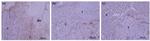 Ki-67 Antibody in Immunohistochemistry (IHC)