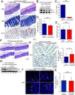 LRIG1 Antibody in Immunohistochemistry, Immunocytochemistry (IHC, ICC/IF)