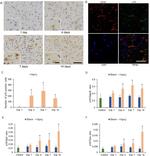 p16INK4a Antibody in Immunohistochemistry, Immunocytochemistry (IHC, ICC/IF)
