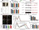 Synaptophysin Antibody in Immunohistochemistry, Immunocytochemistry (IHC, ICC/IF)