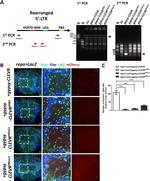 beta Galactosidase Antibody in Immunohistochemistry, Immunocytochemistry (IHC, ICC/IF)