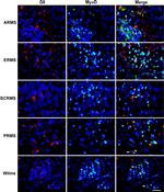 MYOD Antibody in Immunohistochemistry, Immunocytochemistry (IHC, ICC/IF)