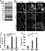 Phospho-FAK (Tyr397) Antibody in Western Blot (WB)