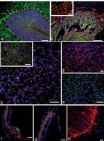 Connexin 43 Antibody in Immunohistochemistry (IHC)