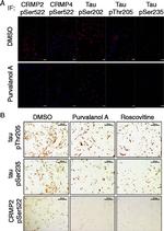 Phospho-Tau (Thr205) Antibody in Immunohistochemistry, Immunocytochemistry (IHC, ICC/IF)