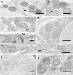 TurboGFP Antibody in Immunomicroscopy (IM)