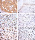 KIAA1429 Antibody in Immunohistochemistry, Immunocytochemistry (IHC, ICC/IF)
