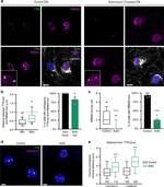 Rbm20 Antibody in Immunocytochemistry (ICC/IF)