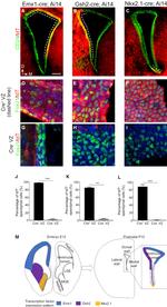 FOXJ1 Antibody in Immunohistochemistry (IHC)