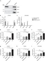 Mycobacterium tuberculosis CFP-10 Antibody in Western Blot (WB)