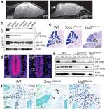 PAX2 Antibody in Immunohistochemistry (IHC)