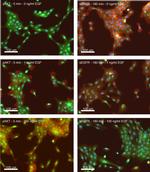 EGFR Antibody in Immunocytochemistry (ICC/IF)