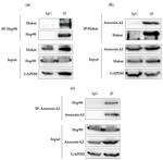 CBLL1 Antibody in Western Blot (WB)