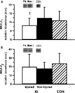 ATP1B1 Antibody in Western Blot (WB)