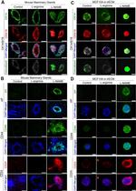 Cytokeratin 14 Antibody in Immunocytochemistry (ICC/IF)