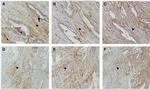 Alpha-Smooth Muscle Actin Antibody in Immunohistochemistry (IHC)