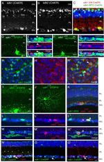 Opsin 4 Antibody in Immunohistochemistry, Immunocytochemistry (IHC, ICC/IF)