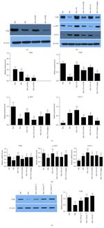 UCP2 Antibody in Western Blot (WB)