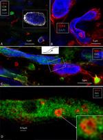 HLA-DR Antibody in Immunohistochemistry (IHC)