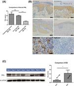 Prolactin Antibody in Immunohistochemistry (IHC)