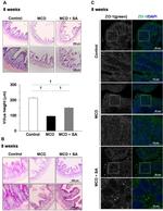 ZO-1 Antibody in Immunohistochemistry, Immunocytochemistry (IHC, ICC/IF)